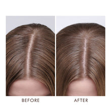 Load image into Gallery viewer, Dry Scalp Treatment

